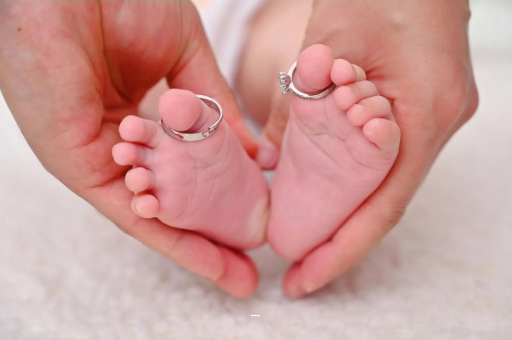 眉山孕妇怎样预防妊娠纹